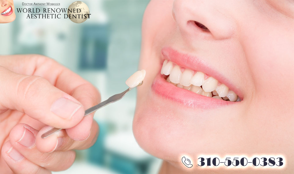 The Best Veneer Dentist Can Change Your Smile
